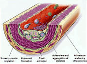 arterial_wall_cross_section_showing_chronic_infection_133