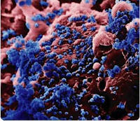 influenza_virus_200